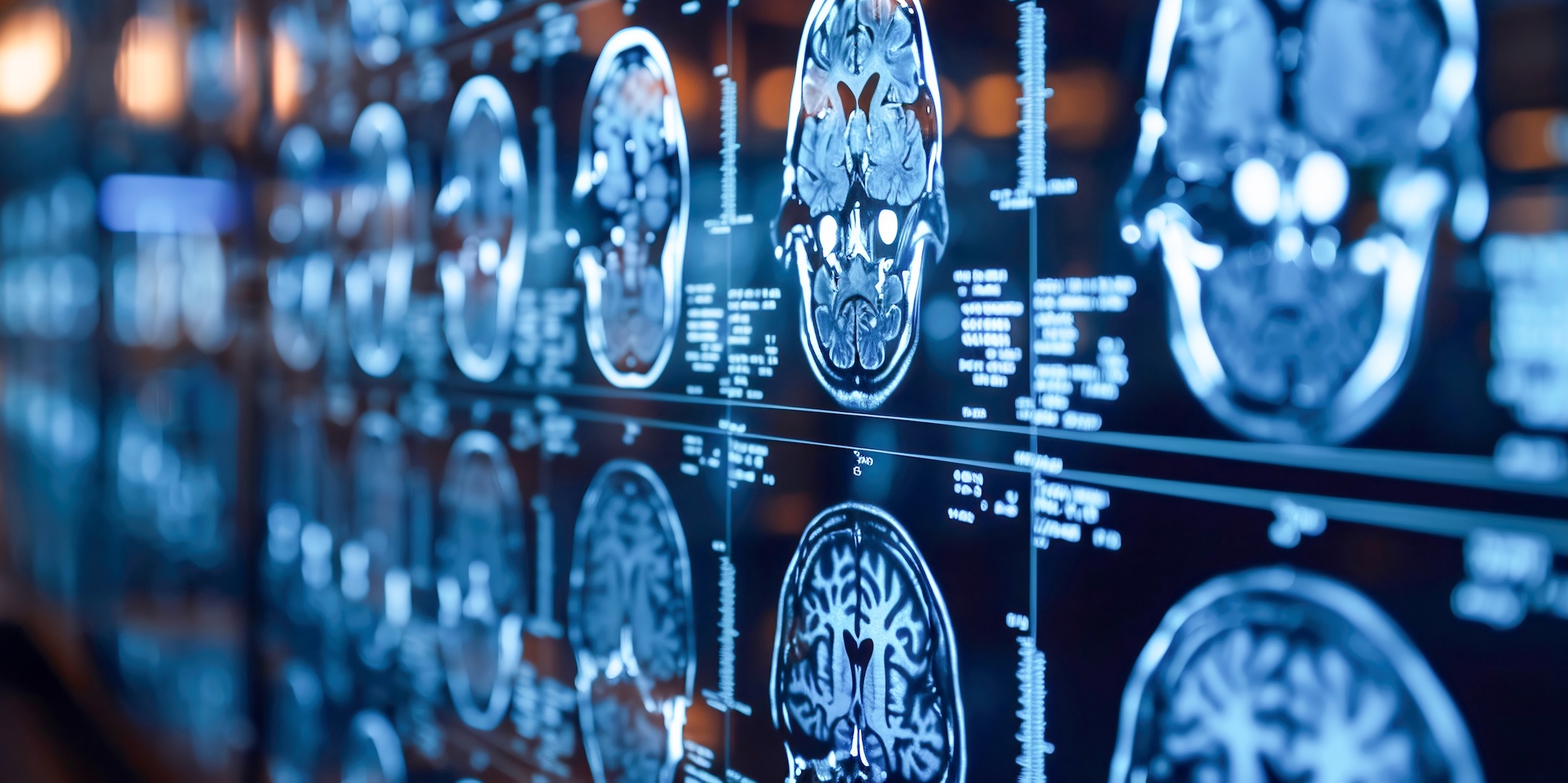 MRT-Aufnahmen eines menschlichen Gehirns